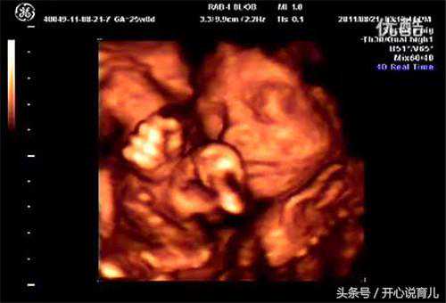 从二胎反应可看出生男生女？医生告诉你二胎与一胎的区别！