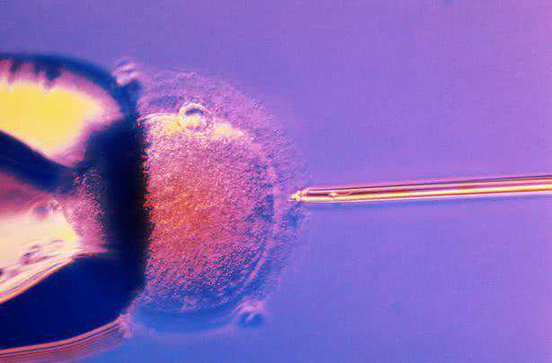 世界首例！法国癌症女子用体外成熟技术冻卵诞下健康婴儿